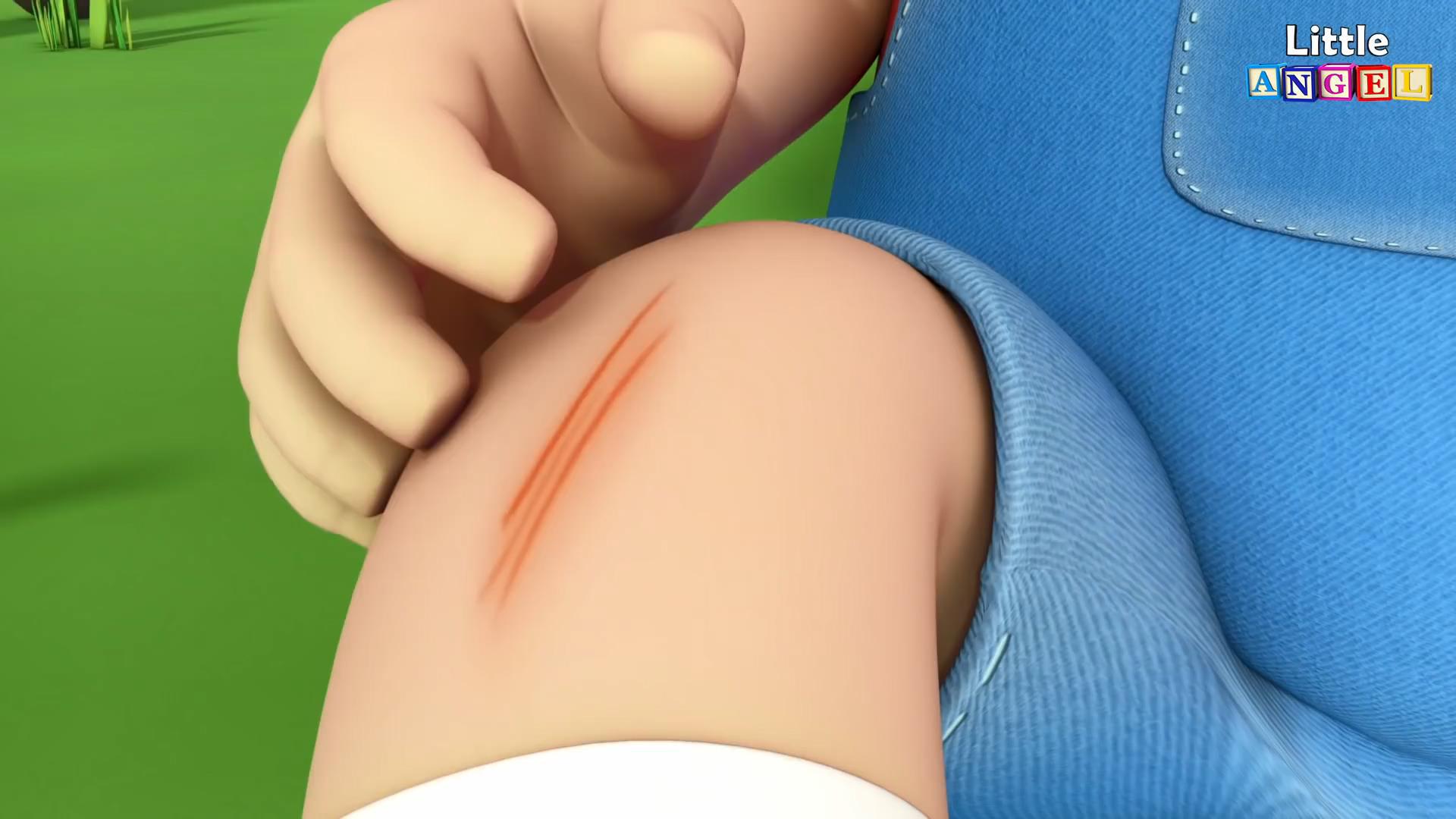 Baby Gets a Boo Boo - Boo Boo Song
